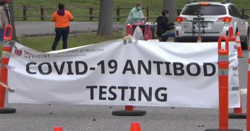 Large-scale COVID-19 antibody testing 